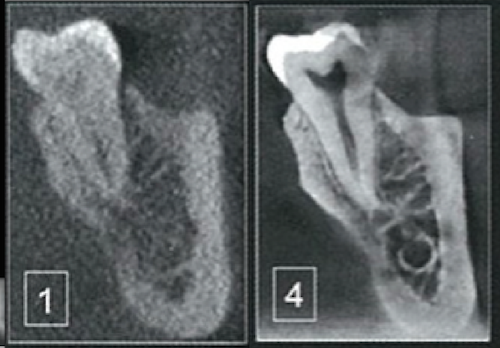 東京顕微鏡歯科超高画質マイクロCBCT