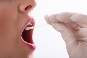 唾液検査で虫歯リスクがわかる？サリバテストで見えるお口の環境