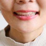 口ゴボとは？Eラインとの関係と原因・治療法